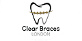 Clear Braces London